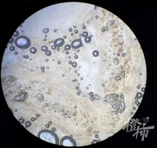 一家四口全中招!一到晚上痒到怀疑人生,“抓得满是血痕”,一查竟是…… 一家四口全中招!一到晚上痒到怀疑人生,“抓得满是血痕”,一查竟是……