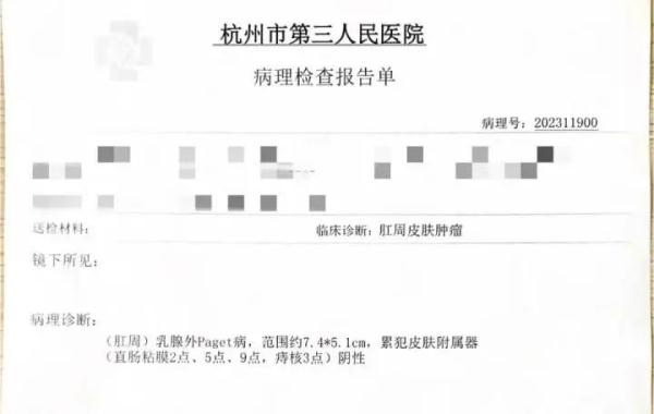 每次便完"菊花"痒，一查竟是癌！"菊"部情况别大意