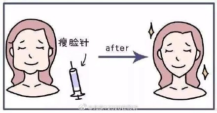 注射肉毒素的注意事项