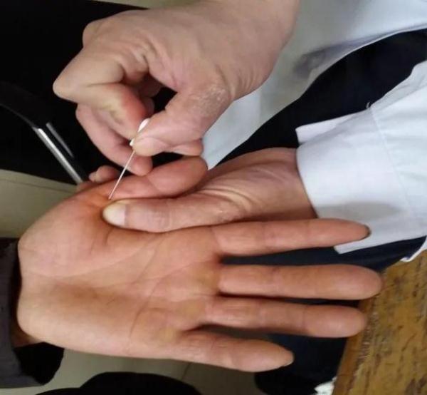 “妈，我手脖子疼！”“玩手机玩的！”