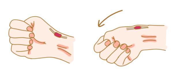 “妈，我手脖子疼！”“玩手机玩的！”