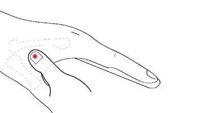 “妈，我手脖子疼！”“玩手机玩的！”