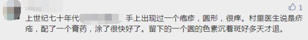 一家四口全中招！一到晚上痒到怀疑人生，“抓得满是血痕”，一查竟是……