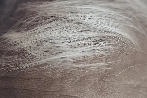 白发长在哪，病就从哪来吗？这3处尤其要注意！