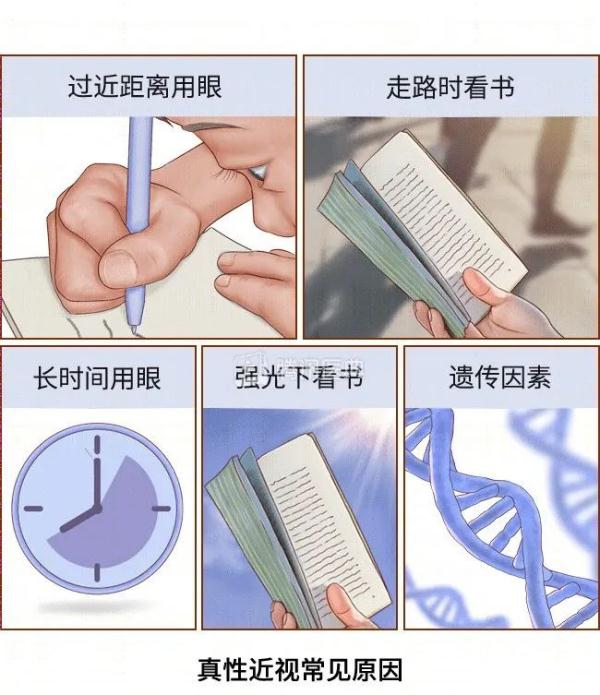 关于近视的几大误区，请注意！