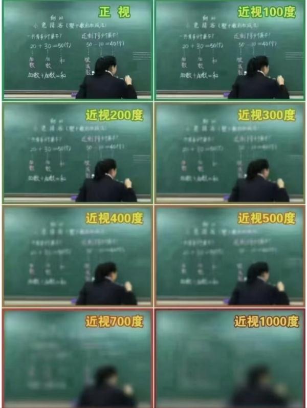 关于近视的几大误区，请注意！