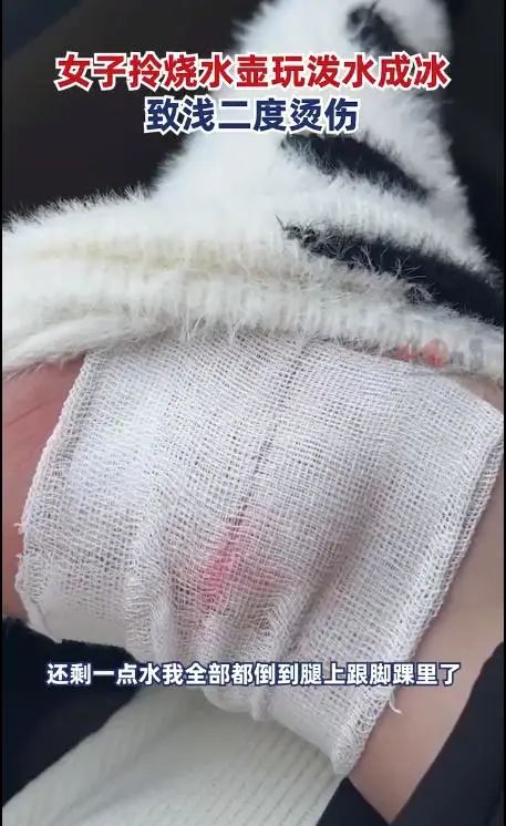 拎烧水壶玩“泼水成冰”?女子把自己烫得满脚大泡 拎烧水壶玩“泼水成冰”?女子把自己烫得满脚大泡