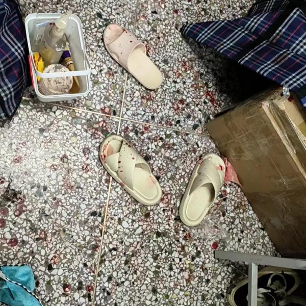 爆了！哈尔滨女孩满脸是血，缝了8针！这种网红饮品很多人在喝…...