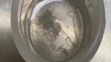 女子双眼取出60多条活虫! 医生:可能接触了有寄生虫的宠物后揉眼睛 女子双眼取出60多条活虫! 医生:可能接触了有寄生虫的宠物后揉眼睛