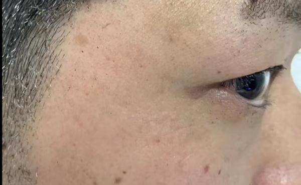 你家孩子有这个玩具吗？长沙一男子戳了一下它，发生爆炸被烧