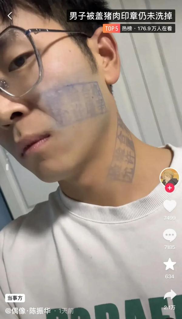 男子脸上被盖猪肉印章,洗不掉了...... 男子脸上被盖猪肉印章,洗不掉了......