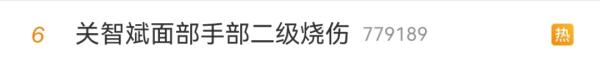 知名男星自曝脸部二级烧伤，紧急提醒→