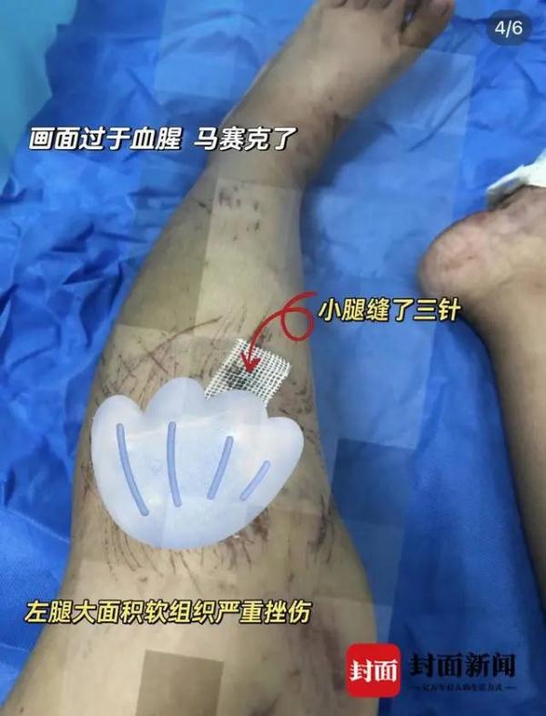 女子打卡知名景点，“差点命丧东南亚”！