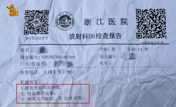 杭州小伙骨折去医院,2次都没查出来?! 杭州小伙骨折去医院,2次都没查出来?!