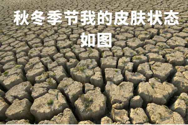 【实用知识】冬季皮肤干燥起皮怎么办？不同年龄段保湿方法有不同→