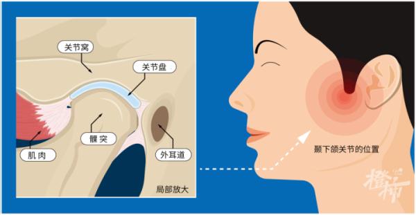 紧急送医！这种病很多人中招，医生提醒