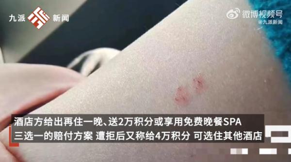女子熟睡时遭遇惊魂一幕！之后...