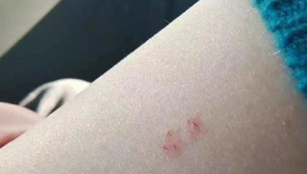 女子称入住上海外滩W酒店被毒蛇咬伤,酒店回应:已封锁涉事房间 女子称入住上海外滩W酒店被毒蛇咬伤,酒店回应:已封锁涉事房间