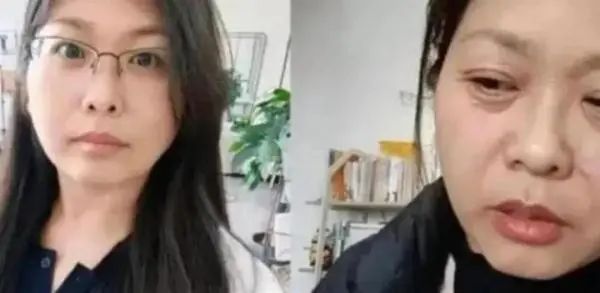 女子20天内“断崖式衰老”?医生:这些情况要警惕 女子20天内“断崖式衰老”?医生:这些情况要警惕