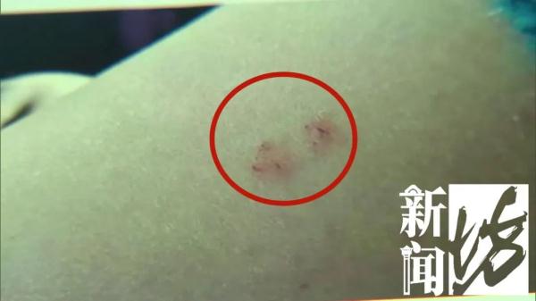 2500元住上海顶级酒店熟睡中被蛇咬伤？官方：蛇没找到，双方初步和解
