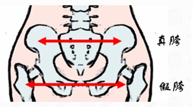 “臀塌腿粗”?可能是“假胯宽”惹的祸 “臀塌腿粗”?可能是“假胯宽”惹的祸