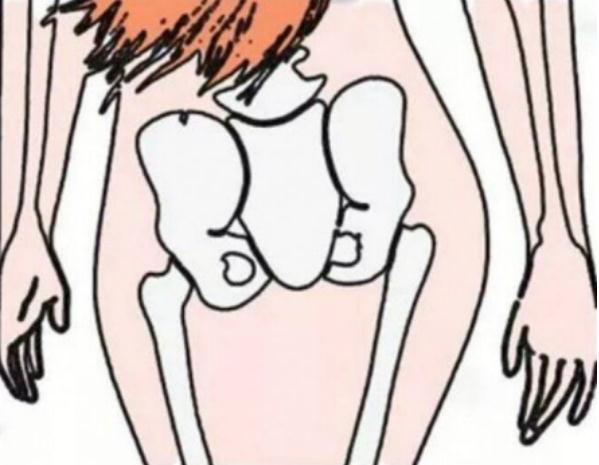 “臀塌腿粗”?可能是“假胯宽”惹的祸 “臀塌腿粗”?可能是“假胯宽”惹的祸