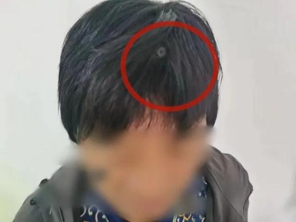 戴假发藏摄像头、双腿绑手机！昆明一男子为了这场考试也是“拼了”