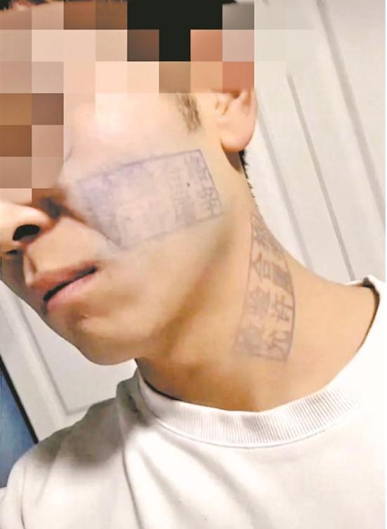 小伙脸上被盖猪肉印章，时隔五天终于洗掉，但是……