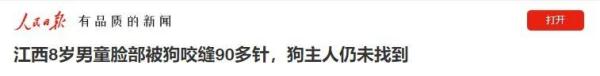8岁男童被狗扑咬,缝90多针! 8岁男童被狗扑咬,缝90多针!
