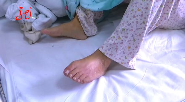 “求你截掉我的大腿！”哈尔滨一女子恳求医生：“受不了了！”