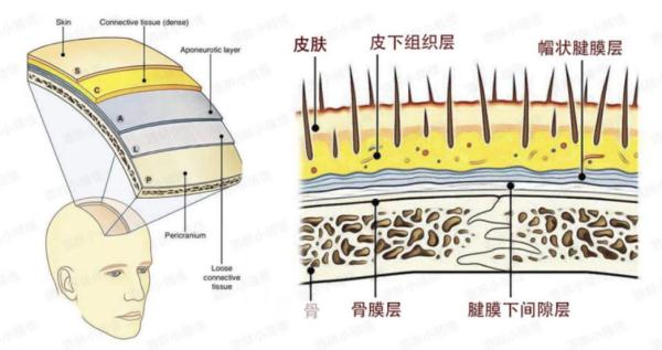 追求“高颅顶”注射50来支玻尿酸，百万粉丝女网红变成“鬼剃头” 