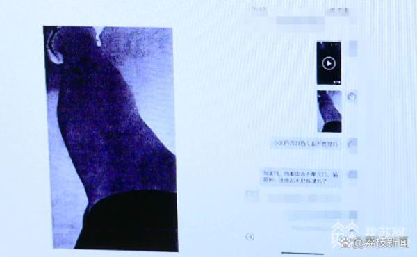 小区内被流浪猫抓伤，物业要不要担责？