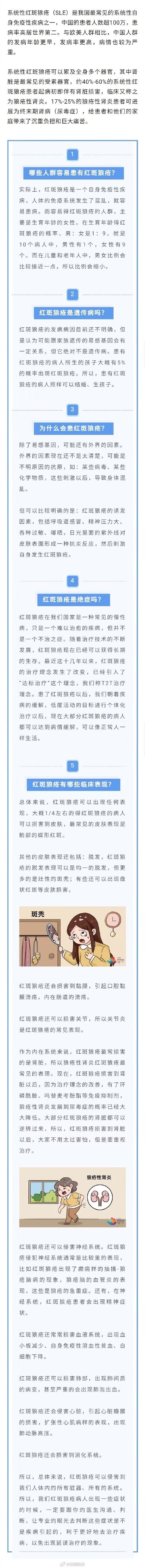 红斑狼疮高发人群是年轻女性 红斑狼疮高发人群是年轻女性
