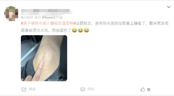 一夜醒来腿被烫熟？教你防住低温烫伤“背刺”