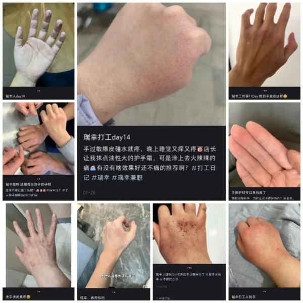 伤痕累累，全网关注！瑞幸咖啡师“烂手”谁之过？记者蹲点上海门店→