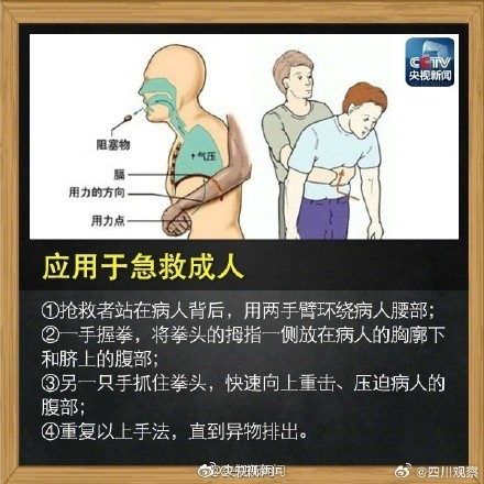 记住这个海姆立克急救法！关键时刻能救命