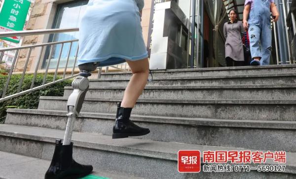 因车祸截肢,南宁95后女孩把假肢戴成“时尚单品”! 因车祸截肢,南宁95后女孩把假肢戴成“时尚单品”!
