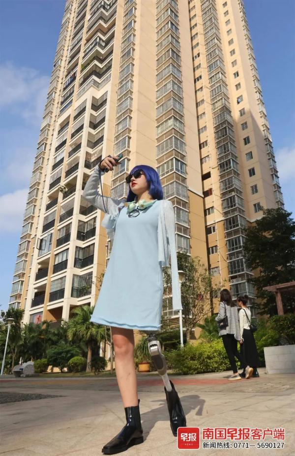 因车祸截肢,南宁95后女孩把假肢戴成“时尚单品”! 因车祸截肢,南宁95后女孩把假肢戴成“时尚单品”!