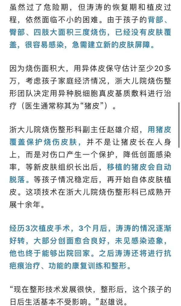 “轰”一声，男孩瞬间成为火人！医生：家庭常备的这种东西要小心