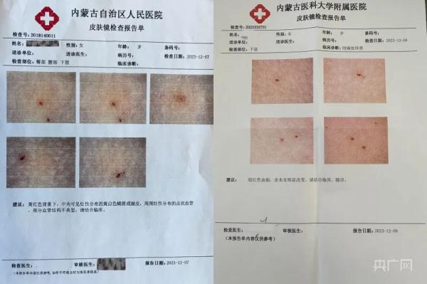 查监控被拒、家长改口！“幼儿园女童被扎”事件须尽快给个交代！