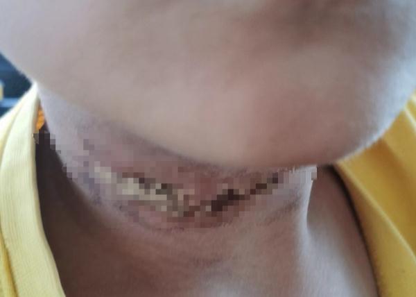 深圳9岁男孩骑单车脖子被狗绳勒伤?回应:已找到狗主人,正组织协商 深圳9岁男孩骑单车脖子被狗绳勒伤?回应:已找到狗主人,正组织协商