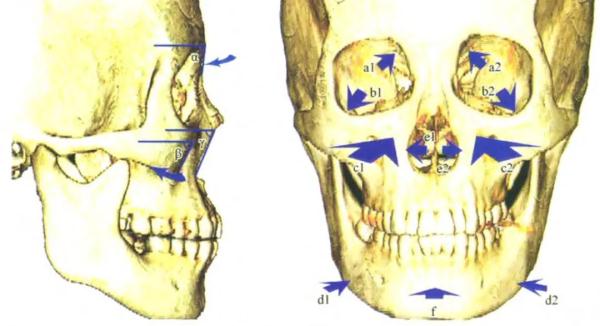 为什么人越老，脸越大？（不是发福）