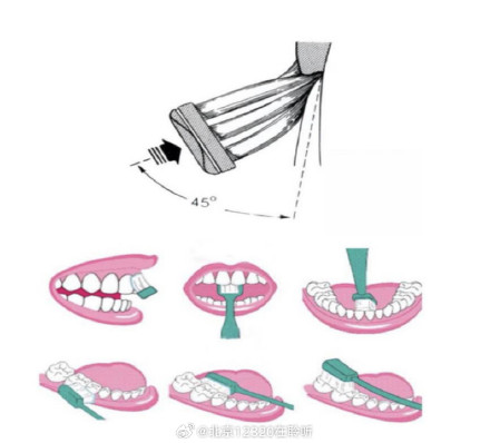 如何使用水平颤动拂刷法刷牙？
