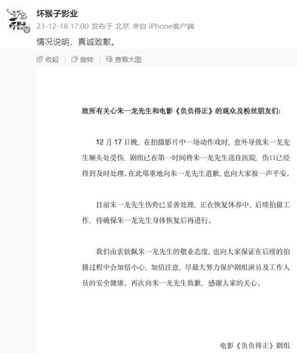 知名男演员,意外受伤! 知名男演员,意外受伤!