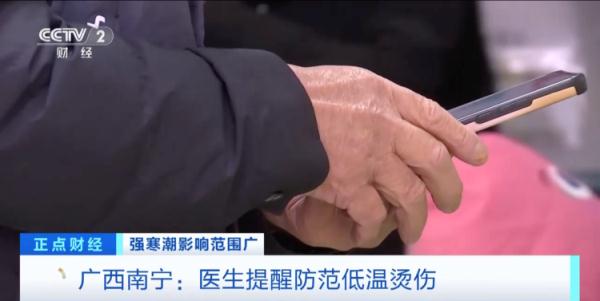 冬季警惕发生低温烫伤!医生提醒:不要通宵使用电热毯 冬季警惕发生低温烫伤!医生提醒:不要通宵使用电热毯