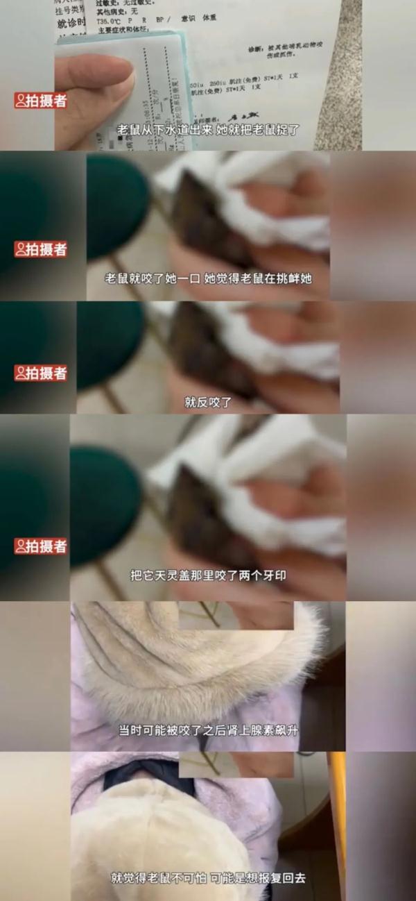 狠人！女生被老鼠咬后，反咬老鼠头报仇？室友：天灵盖上两牙印