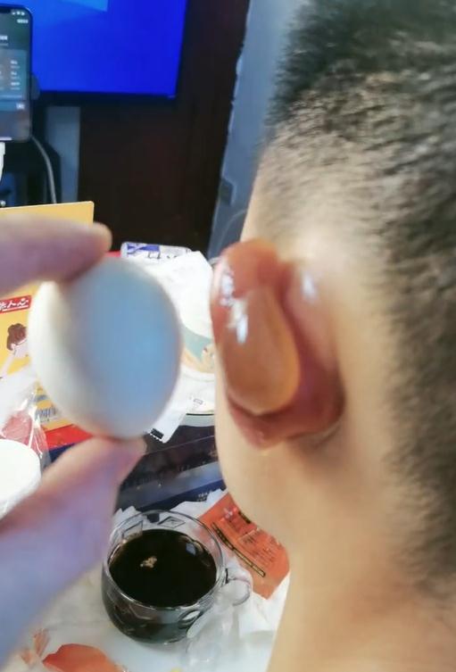 警惕!小伙户外游玩两小时,耳朵被冻化脓!这些防冻知识赶紧学 警惕!小伙户外游玩两小时,耳朵被冻化脓!这些防冻知识赶紧学