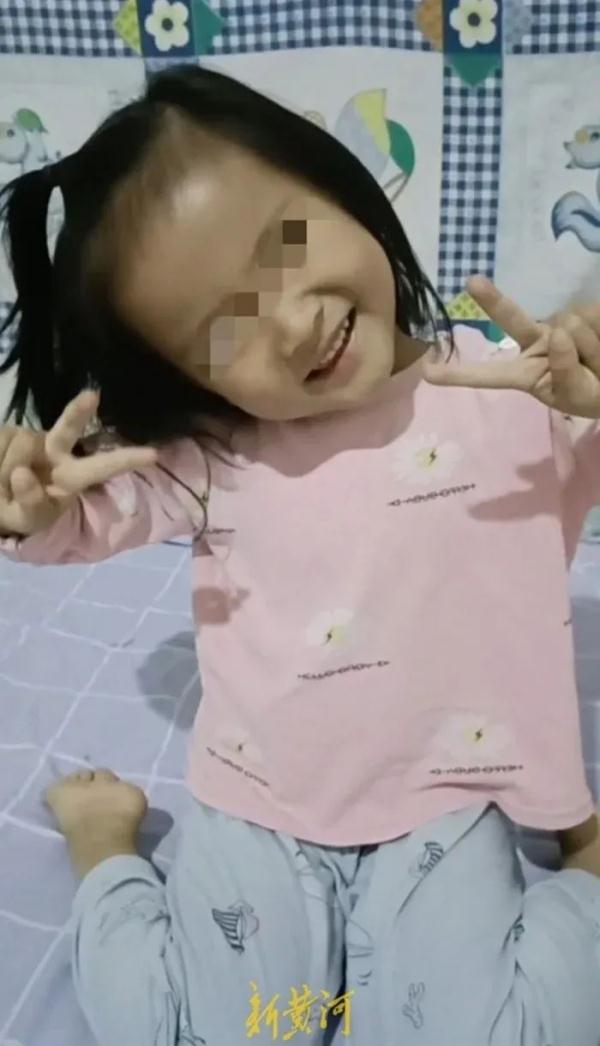 痛心！4岁女童遭3条狗咬掉大半头皮，当地警方回应