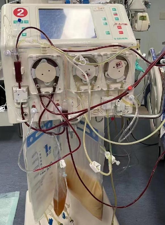 男子在ICU抢救20多天,抽出3000毫升“牛奶血”!厦门医生紧急提醒→ 男子在ICU抢救20多天,抽出3000毫升“牛奶血”!厦门医生紧急提醒→