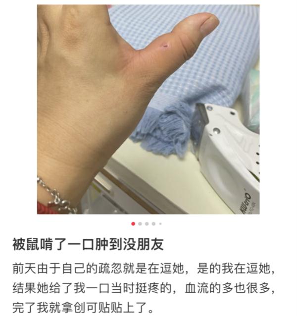 江苏一女子被老鼠咬后反咬回去!医生:当时我也蒙了 江苏一女子被老鼠咬后反咬回去!医生:当时我也蒙了